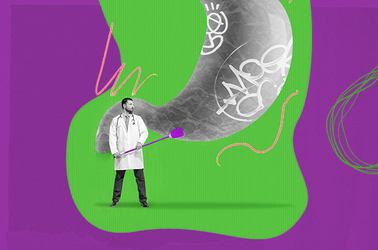 Leczenie dyspepsji czynnościowej - rozwiązania wielokierunkowe