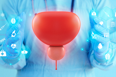 BPH w praktyce: jak dopasować terapię do pacjenta, nie tylko do objawów